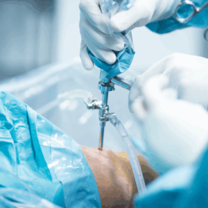 Arthroscopy (Keyhole Surgery)