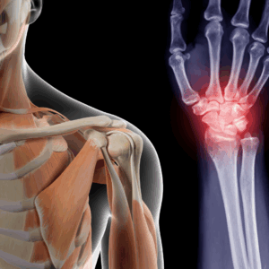 Complex Trauma Management