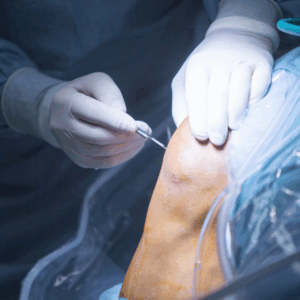 Robotic Joint Replacement Surgery